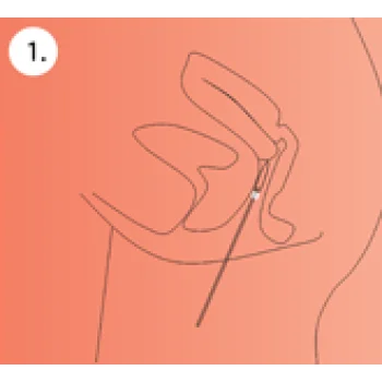 Chlamydia Health Care Test