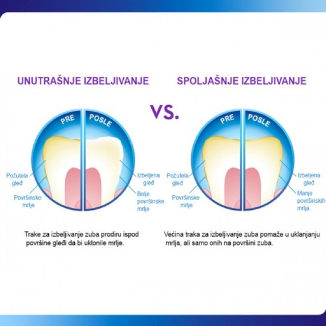 Medisana ULTRA WHITE Trake za izbeljivanje zuba - Online Apoteka Medisana ULTRA WHITE Trake za izbeljivanje zuba