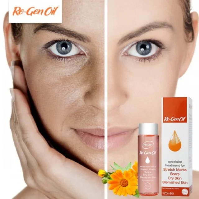 Re-Gen Oil 75ml - Online Apoteka Re-Gen Oil 75ml